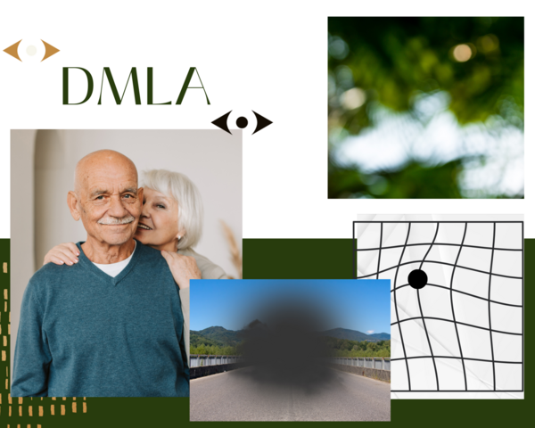 Les vrais signes de la DMLA ses urgences